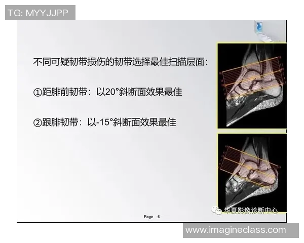 足球脚肌肉的力量与灵活性训练方法解析及其对运动表现的影响